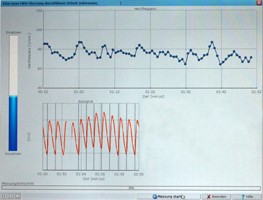 Burnout Therapie bei Erschöpfungssyndrom und Stress