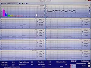 Neurofeedback Messung Hypnose Hypnocranios